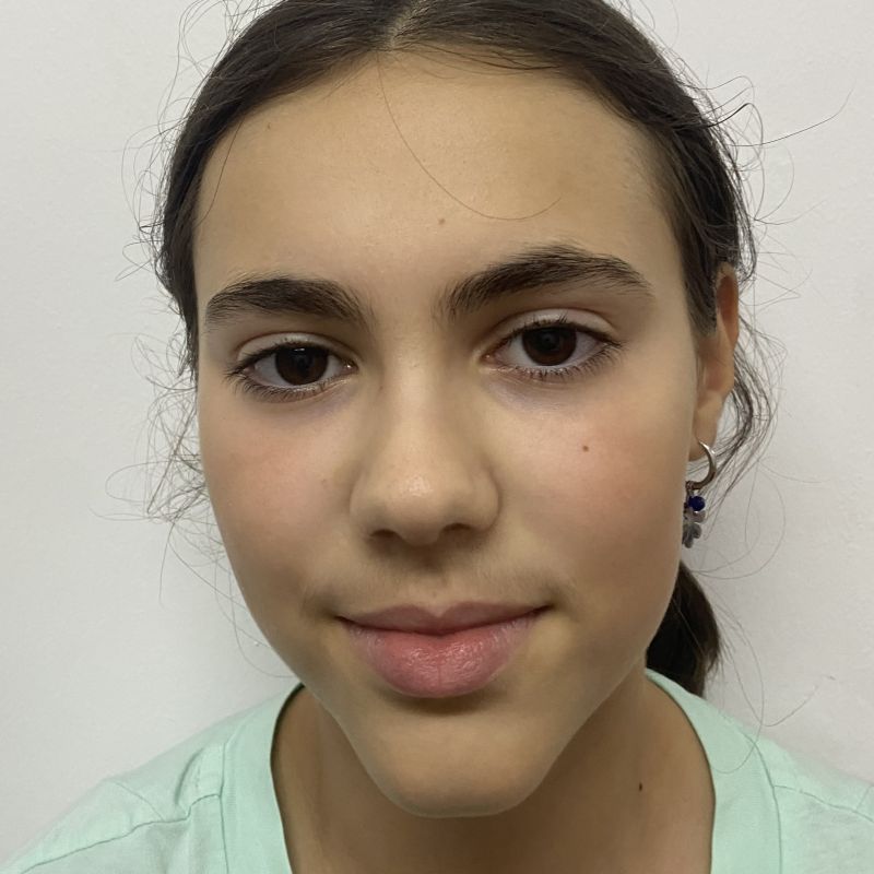 NEREA LORENZO ROMERO