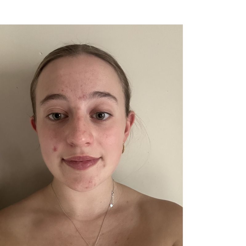 INES GONZALEZ PRECEDO