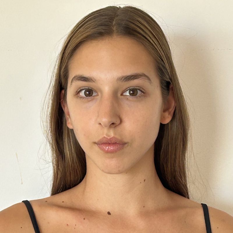 BERTA ALOCEN MEDIANERO