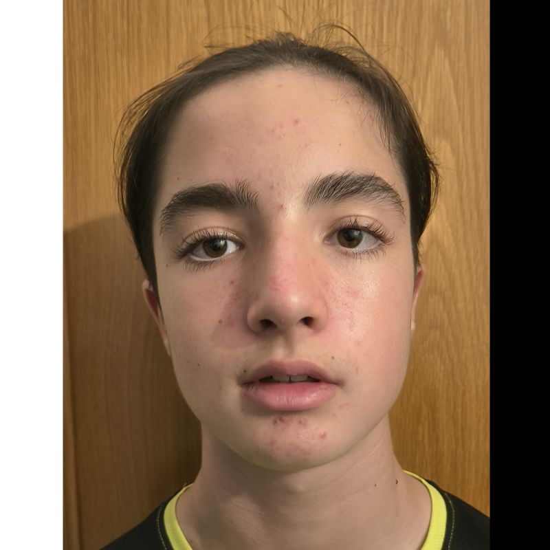 DIDAC ROQUE CONTRERAS