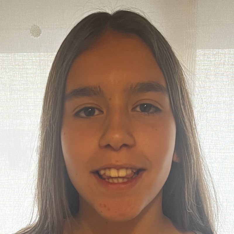 AROA ALVAREZ ANILLO