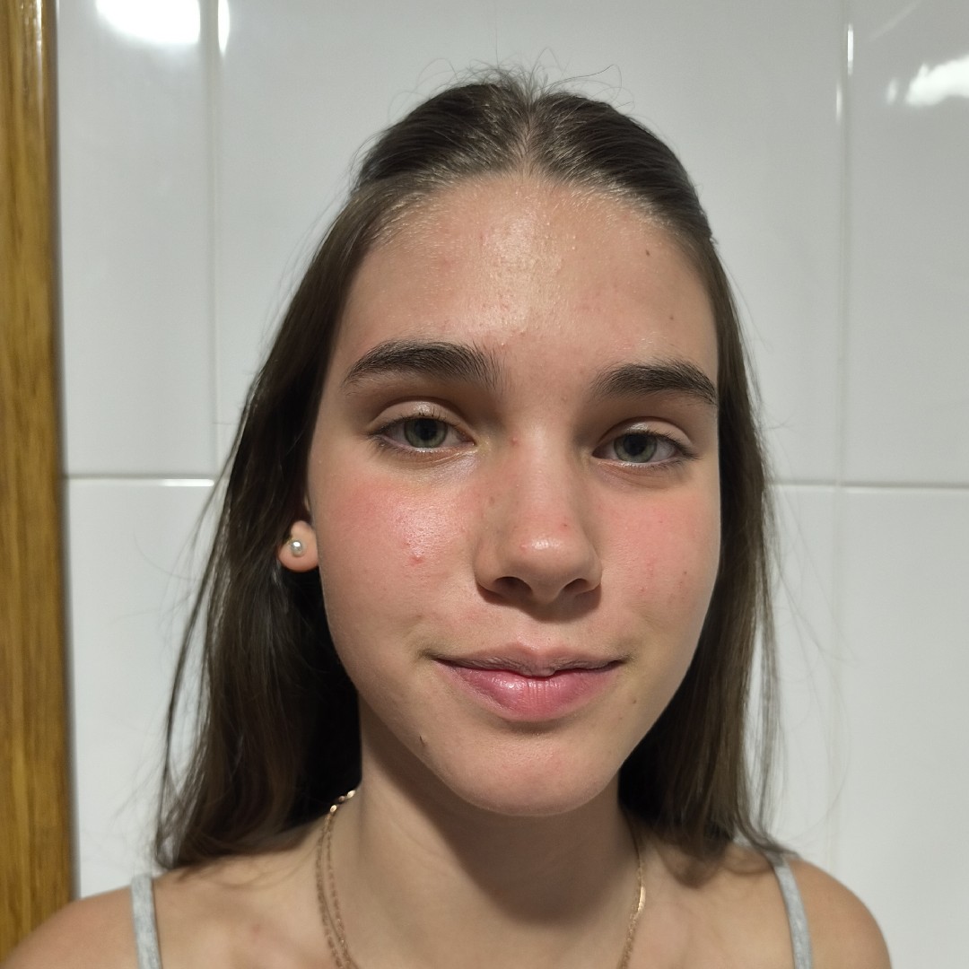 EDURNE MARTINEZ BEZUNARTEA