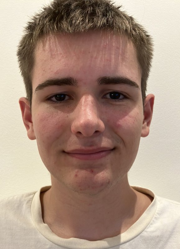 BRAULIO MARTINEZ DE LORENZO