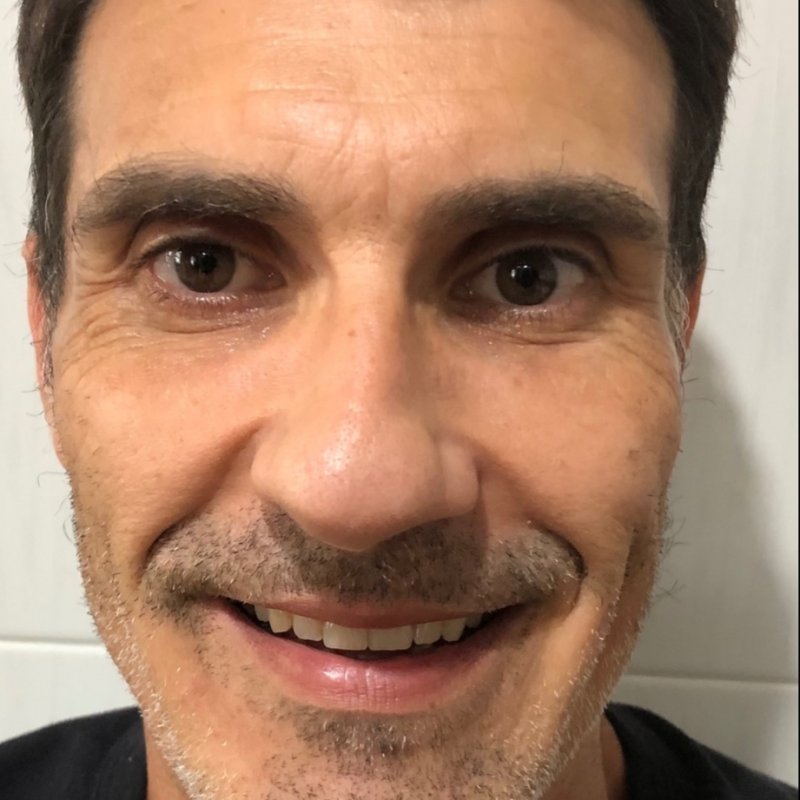 JOSE VALLE PICO